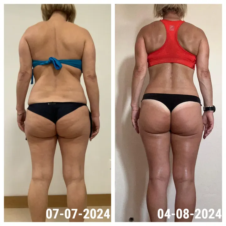 Antes e depois de uma aluna InShape: Glúteos e costas transformados