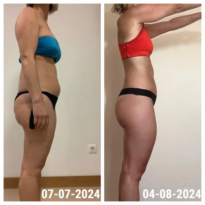 Antes e depois de uma aluna InShape: Abdómen visivelmente mais liso