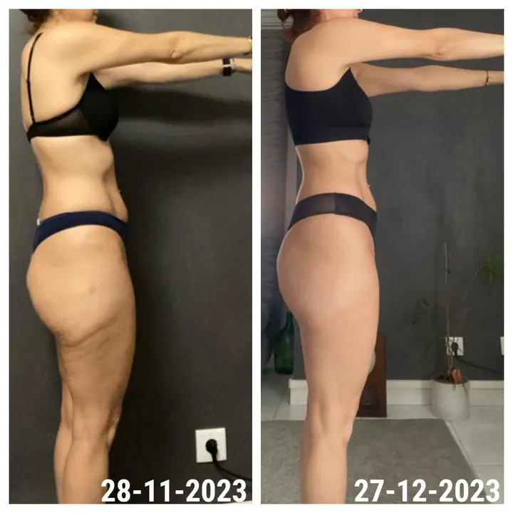 Antes e depois de uma aluna InShape: Cintura marcada e postura melhor