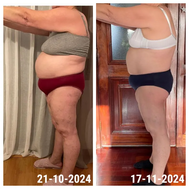 Antes e depois de uma aluna InShape: Resultados sem dietas extremas